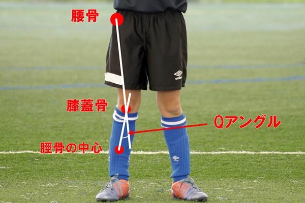 anterior cruciate ligament injury.JPG